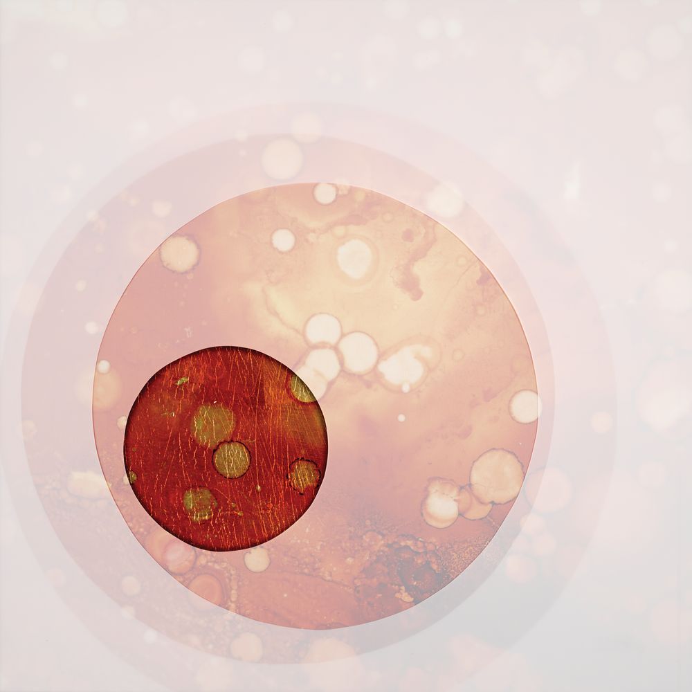 Endless Worlds 4 artwork